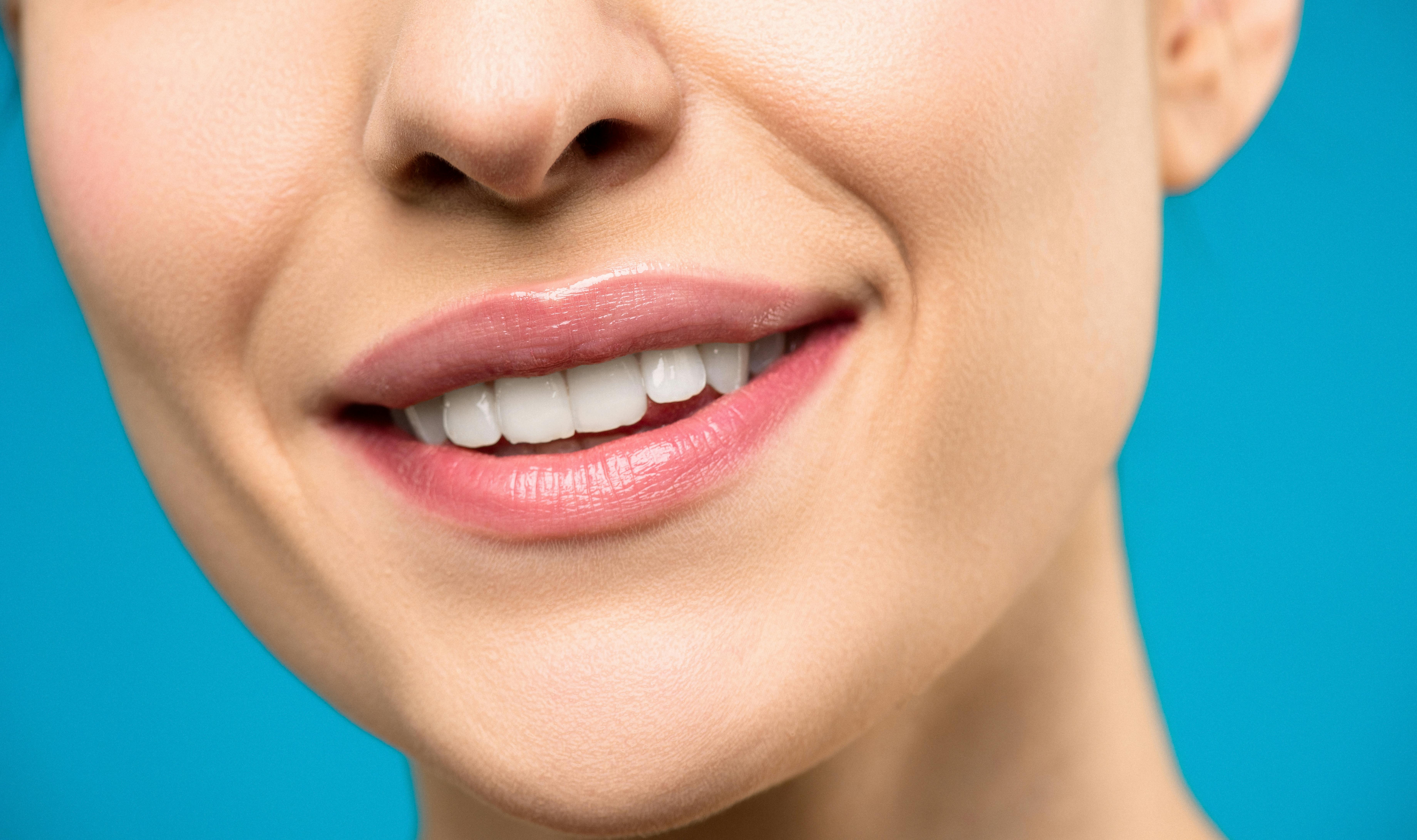 Estética Dental